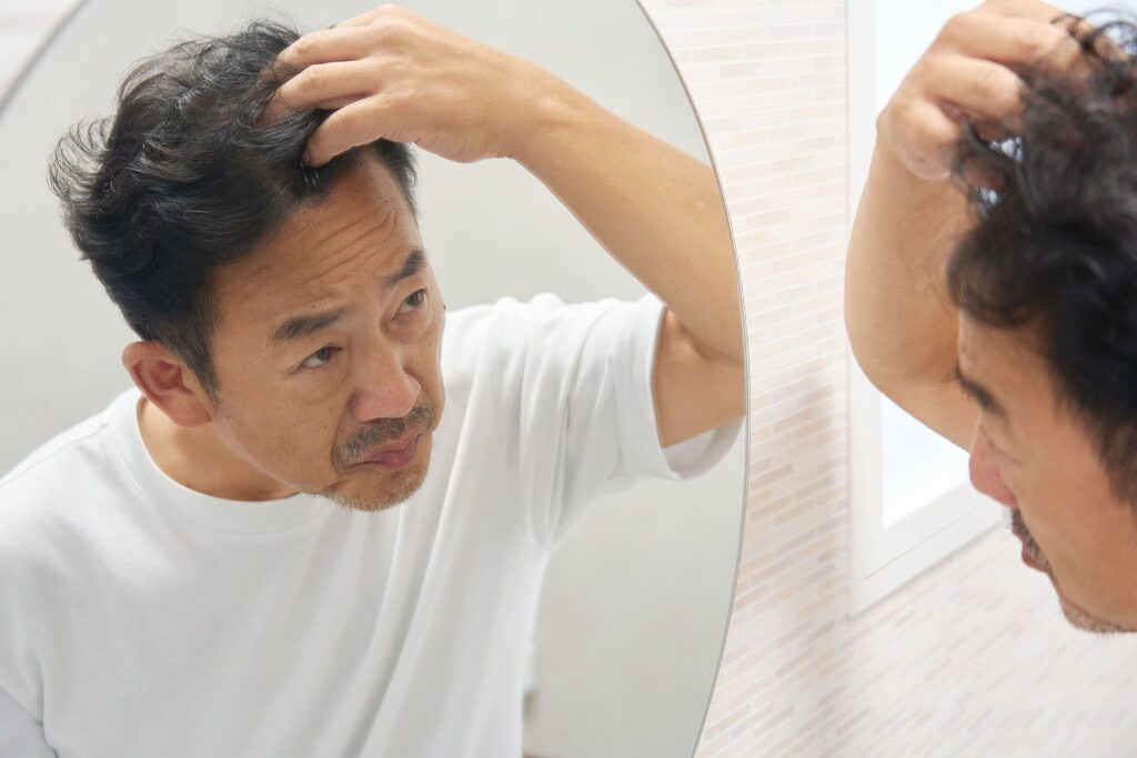 AGAはどこから始まるのか?男性が知っておくべき初期サインと早期対策|KANDA NISHIGUCHI CLINIC