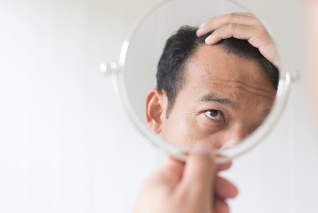 AGAはどこから始まるのか?男性が知っておくべき初期サインと早期対策|KANDA NISHIGUCHI CLINIC