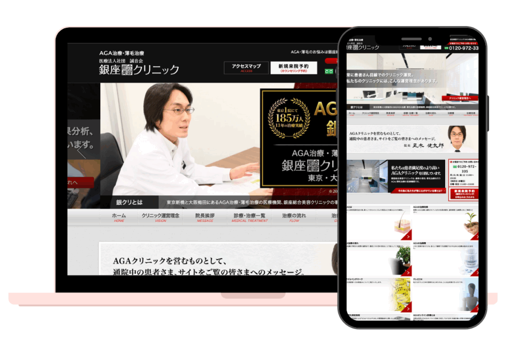 銀座総合クリニック＿AGAおすすめ