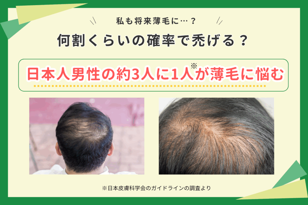 何割くらいの確率で禿げてしまうのか調査
